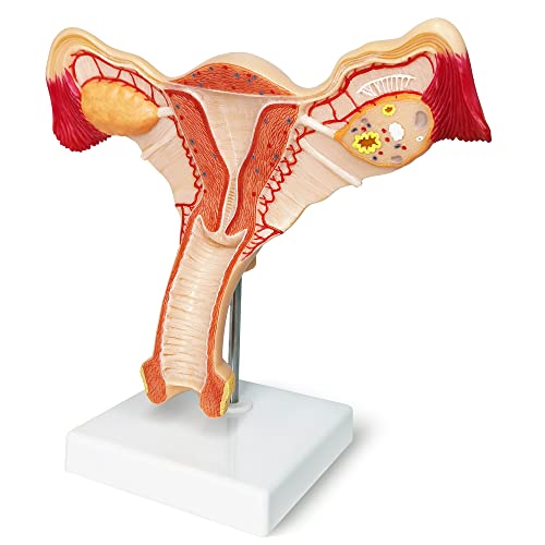 EVOTECH Human Uterus and Ovary Model, 2022 Newest Female Reproductive Organ Model, Female Genital Organ, Shows Uterus, Ovary, Vagina, Uterine Medical Teaching Anatomical Gynecology