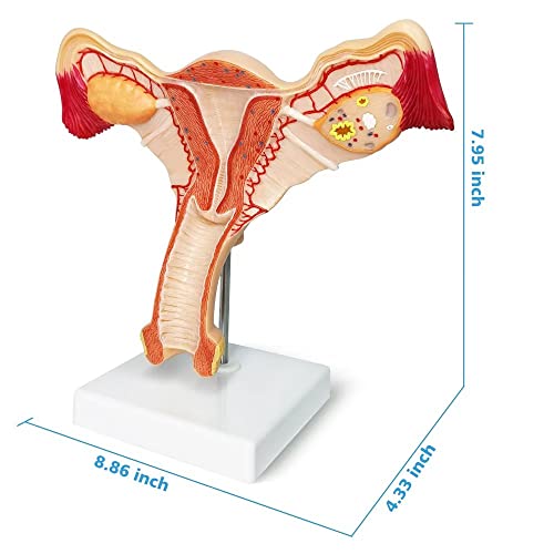 EVOTECH Human Uterus and Ovary Model, 2022 Newest Female Reproductive Organ Model, Female Genital Organ, Shows Uterus, Ovary, Vagina, Uterine Medical Teaching Anatomical Gynecology