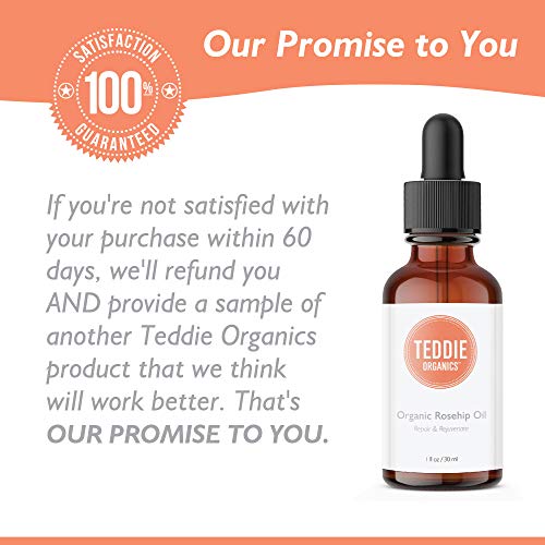 Teddie Organics Rosehip Seed Oil for Face, Hair and Skin 1oz, Pure Rose Hip Oil (Works as a Carrier and Facial Oil)