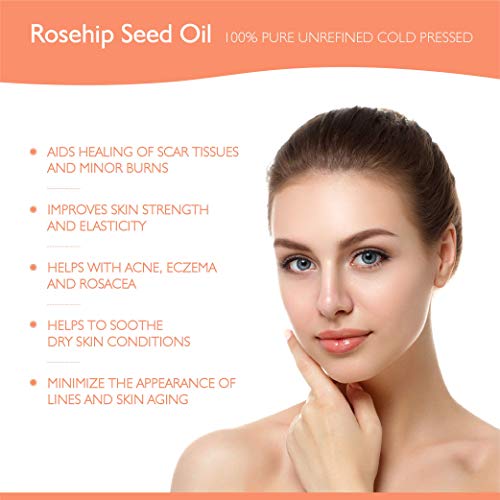 Teddie Organics Rosehip Seed Oil for Face, Hair and Skin 1oz, Pure Rose Hip Oil (Works as a Carrier and Facial Oil)