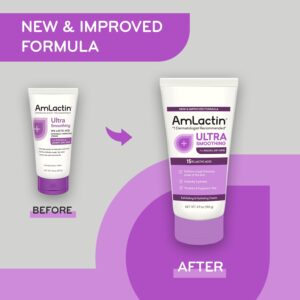 AmLactin Ultra Smoothing - 4.9 oz Body & Hand Cream with 15% Lactic Acid - Exfoliator and Moisturizer for Rough and Bumpy Dry Skin (Packaging May Vary)