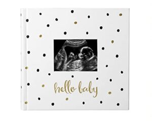 pearhead hello baby photo album, baby book keepsake for new and expecting parents, gender-neutral baby accessory, holds 200 photos, black and gold polka dot