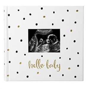 Pearhead Hello Baby Photo Album, Baby Book Keepsake for New and Expecting Parents, Gender-Neutral Baby Accessory, Holds 200 Photos, Black and Gold Polka Dot