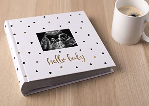 Pearhead Hello Baby Photo Album, Baby Book Keepsake for New and Expecting Parents, Gender-Neutral Baby Accessory, Holds 200 Photos, Black and Gold Polka Dot