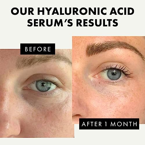 𝗧𝗢𝗣 𝟮𝟬𝟮𝟯* Hyaluronic Acid Face Serum - 2.5% Pure Hyaluronic Serum + 3% B5, Anti Wrinkle + Anti Aging Serum for Face with Vitamin C & E, Aloe - Antiaging Hydrating Serum, Hylunaric Acid Serum