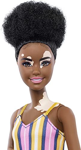 Barbie Fashionistas Doll #135 with Natural Curly Hair and Vitiligo Wearing Striped Dress and Accessories