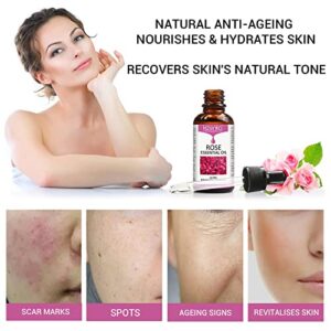 Rose Essential Oil, Face Rose Oil, Moisturizer Rose Oil, Anti Ageing & Anti Wrinkle Serum, Rose oil for Face, Skin Care - 30ml