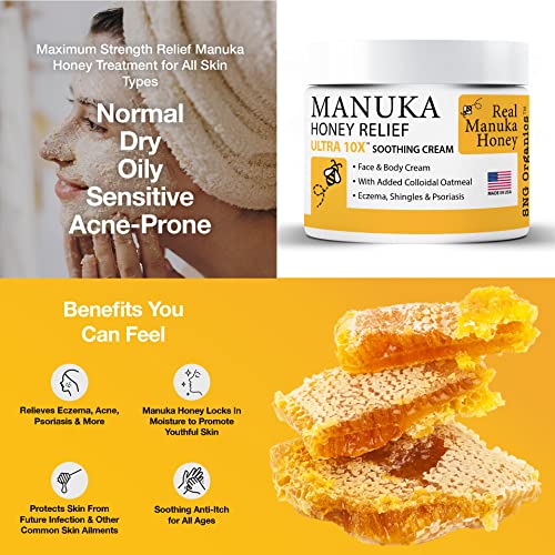 Manuka Honey Eczema Cream (2oz) Moisturizing Lotion Treatment Relief - Itchy, Dry Skin Healing Ointment - Skin-Soothing Moisturizer For Kids, Adults, Baby Body Mousse Honey Creme Eczema, Psoriasis