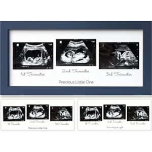 sonogram picture frame - trio ultrasound picture frames for mom to be gift - baby ultrasound frame - pregnancy announcements sonogram frame - baby nursery decor, pregnant mom gifts (midnight blue)