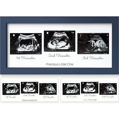 Sonogram Picture Frame - Trio Ultrasound Picture Frames For Mom To Be Gift - Baby Ultrasound frame - Pregnancy Announcements Sonogram frame - Baby Nursery Decor, Pregnant Mom Gifts (Midnight Blue)