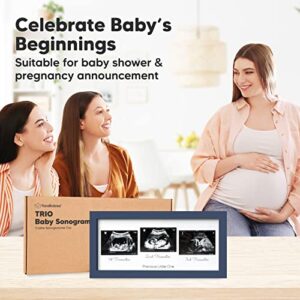 Sonogram Picture Frame - Trio Ultrasound Picture Frames For Mom To Be Gift - Baby Ultrasound frame - Pregnancy Announcements Sonogram frame - Baby Nursery Decor, Pregnant Mom Gifts (Midnight Blue)