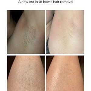 Ulike Laser Hair Removal for Women and Men, Air 3 IPL Hair Removal with Sapphire Ice-Cooling System for Nearly Painless & Long-Lasting Result, Flat-Head Window for Body & Face at-Home Use