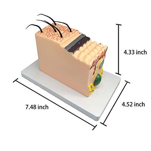 Veipho Skin Anatomy Model, 35X Enlarged Human Skin Layer Structure Anatomical Model with Stand and Hair for Teaching