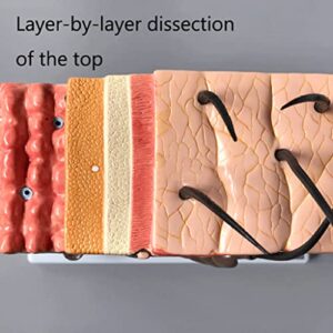 HIRNER Model Teaching Model Skin Anatomy Model Hair Follicle Structure 70x Enlarge Human Anatomy Model for Medical Teaching Learning Aid for Teaching