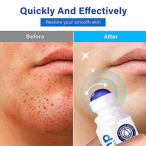 Razor Bump Treatment - Ingrown Hair Treatment for Razor Bumps, After Shave Treatment for Face, Neck, Bikini Area, Legs, With Salicylic Acid, Glycolic Acid