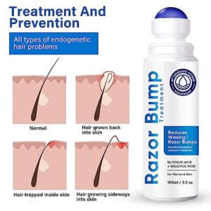 Razor Bump Treatment - Ingrown Hair Treatment for Razor Bumps, After Shave Treatment for Face, Neck, Bikini Area, Legs, With Salicylic Acid, Glycolic Acid