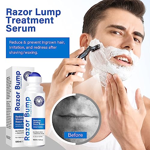 Razor Bump Treatment - Ingrown Hair Treatment for Razor Bumps, After Shave Treatment for Face, Neck, Bikini Area, Legs, With Salicylic Acid, Glycolic Acid