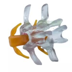 DenFactory Human 1.5 Times Life-Size Transparent Lumbar Disc Herniation Spine Model for Teaching and Learning