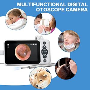 AI Intelligent Visual Digital Otoscope, Hiacinto Ear Wax Removal Tool with 4.5Inch IPS Screen, 3.2mm Ear Camera with Gyroscope, Supports Photo and Video Recording, 32GB Card and Ear Cleaning Kits