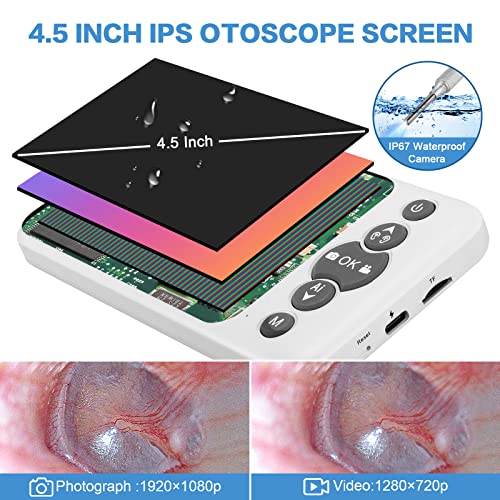 AI Intelligent Visual Digital Otoscope, Hiacinto Ear Wax Removal Tool with 4.5Inch IPS Screen, 3.2mm Ear Camera with Gyroscope, Supports Photo and Video Recording, 32GB Card and Ear Cleaning Kits