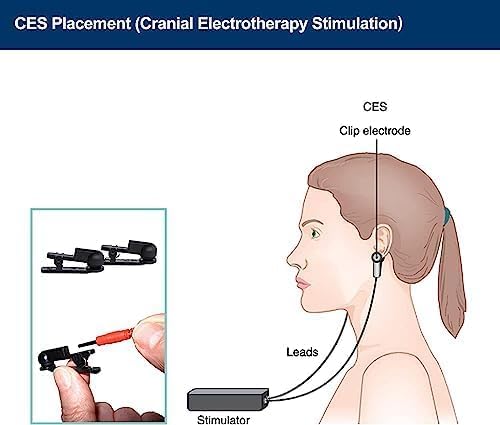 Vagus Nerve Stimulator Ear Clip Compatible with Vagus Nerve Device 2,5 mm Port accompanied by a Vagus Nerve Book