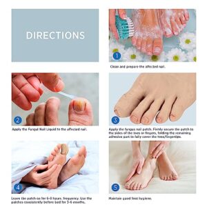 Toenail Fungus Treatment Extra Strength - Nail Fungus Treatment For Toenail, Toe Nail Fungus Treatment Extra Strength, Nighttime Fungal Nail Patches & Fungus Nail Treatment Liquid Set (21patches+15ml)