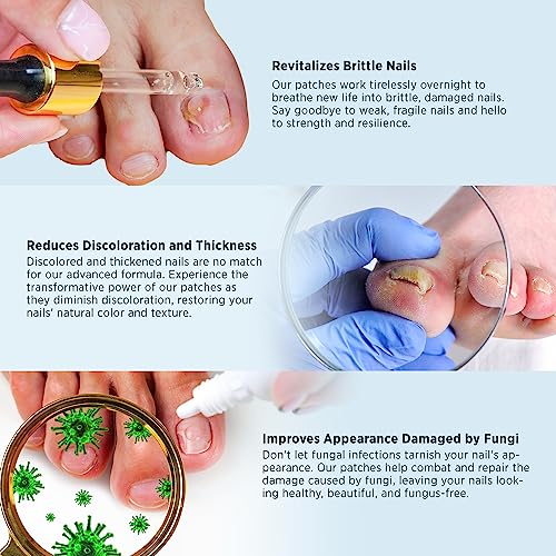 Toenail Fungus Treatment Extra Strength - Nail Fungus Treatment For Toenail, Toe Nail Fungus Treatment Extra Strength, Nighttime Fungal Nail Patches & Fungus Nail Treatment Liquid Set (21patches+15ml)