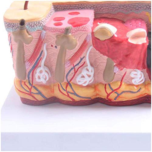 Anatomy Model Skin - Human Burn Skin Anatomy Model -Medical Anatomical Skin Model - for Study Display Taching Medical Model,Medical Educational Aid