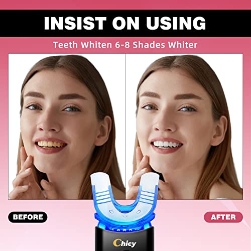 CHICY 2023 Upgraded Teeth Whitening Kit – Latest White Edition, Advanced Home Dental Whitening System with LED Light, Carbamide Peroxide Gel, Custom Trays - Safe, Effective, and Fast Results