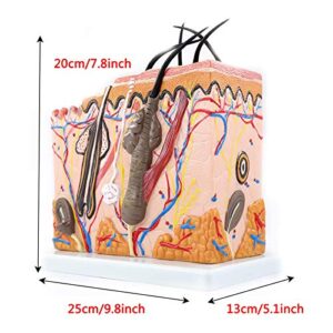 70X Enlarged Human Big Anatomical Skin Magnified Tissue Structure Model for Biology Minimally Invasive Cosmetic Surgery Teaching Model