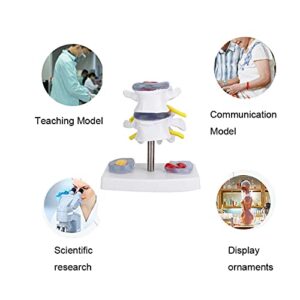 YUYTE Human Spine Model, Human Anatomical Lumbar Disc Herniation Model Human Spine School Training Supplies Excellent Way for Demonstrating Disc, Restore The Details of The Human Spine