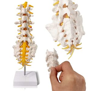 evotech lumbar spine anatomy model with sacrum and spinal nerves, didactic replica of lumbrosacral section with nerves and a herniated disc at l4, includes base for medical teaching display