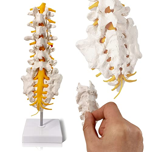 Evotech Lumbar Spine Anatomy Model with Sacrum and Spinal Nerves, Didactic Replica of Lumbrosacral Section with Nerves and A Herniated Disc at L4, Includes Base for Medical Teaching Display