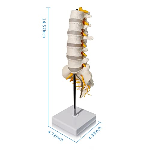 Evotech Lumbar Spine Anatomy Model with Sacrum and Spinal Nerves, Didactic Replica of Lumbrosacral Section with Nerves and A Herniated Disc at L4, Includes Base for Medical Teaching Display