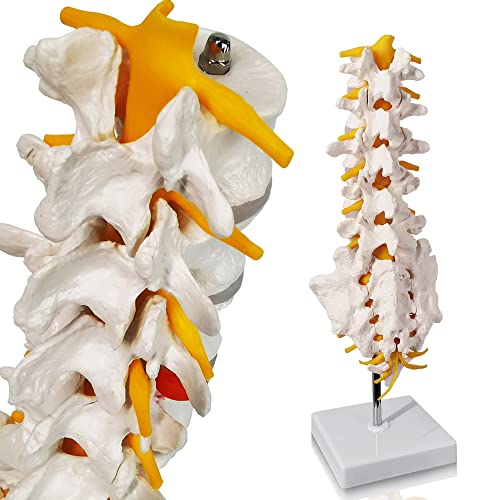 Evotech Lumbar Spine Anatomy Model with Sacrum and Spinal Nerves, Didactic Replica of Lumbrosacral Section with Nerves and A Herniated Disc at L4, Includes Base for Medical Teaching Display