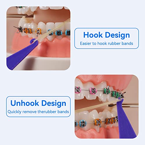Annhua 20 PCS Dental Elastic Rubber Bands Placers, Braces Rubber Band Tool Disposable Plastic Elastic Placers for Braces Bands - Multi-color