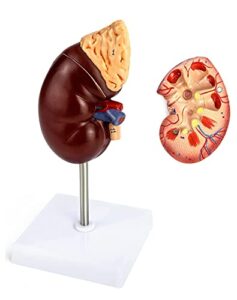 qwork life-size kidney model, divided into 2 parts showing internal structure a normal kidney human anatomy replica for doctors office educational tool