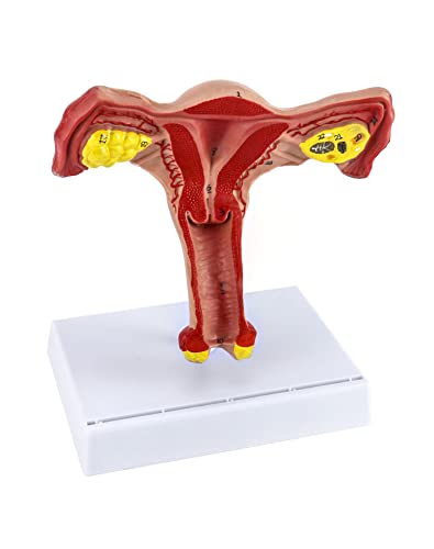 QWORK Human Female Uterus and Ovary Model, Female Genital Organ, Reproductive Organ Model, Uterine Medical Teaching Anatomical Gynecology Uterus and Ovary Model, Human Anatomy Replica