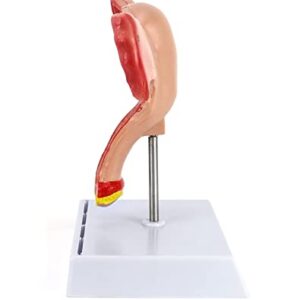 QWORK Human Female Uterus and Ovary Model, Female Genital Organ, Reproductive Organ Model, Uterine Medical Teaching Anatomical Gynecology Uterus and Ovary Model, Human Anatomy Replica