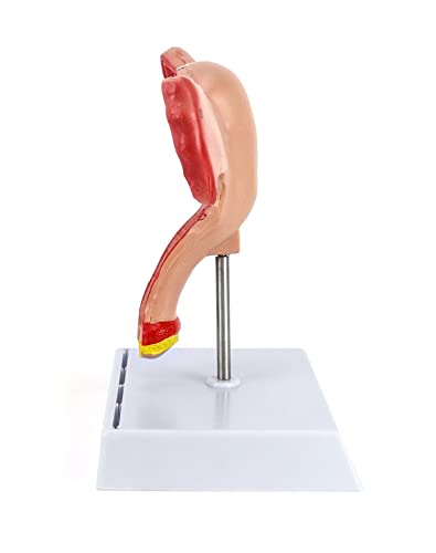 QWORK Human Female Uterus and Ovary Model, Female Genital Organ, Reproductive Organ Model, Uterine Medical Teaching Anatomical Gynecology Uterus and Ovary Model, Human Anatomy Replica