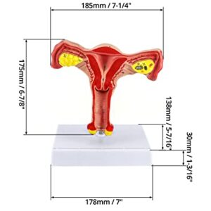 QWORK Human Female Uterus and Ovary Model, Female Genital Organ, Reproductive Organ Model, Uterine Medical Teaching Anatomical Gynecology Uterus and Ovary Model, Human Anatomy Replica