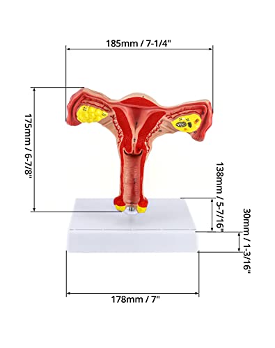 QWORK Human Female Uterus and Ovary Model, Female Genital Organ, Reproductive Organ Model, Uterine Medical Teaching Anatomical Gynecology Uterus and Ovary Model, Human Anatomy Replica