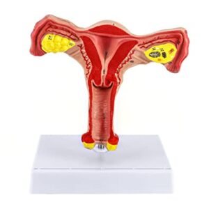 QWORK Human Female Uterus and Ovary Model, Female Genital Organ, Reproductive Organ Model, Uterine Medical Teaching Anatomical Gynecology Uterus and Ovary Model, Human Anatomy Replica