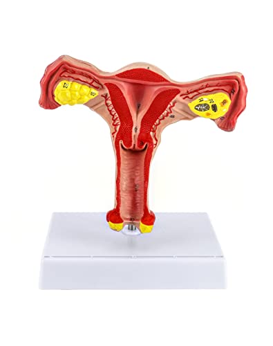 QWORK Human Female Uterus and Ovary Model, Female Genital Organ, Reproductive Organ Model, Uterine Medical Teaching Anatomical Gynecology Uterus and Ovary Model, Human Anatomy Replica