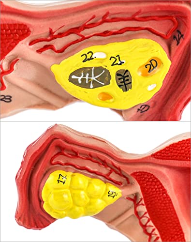 QWORK Human Female Uterus and Ovary Model, Female Genital Organ, Reproductive Organ Model, Uterine Medical Teaching Anatomical Gynecology Uterus and Ovary Model, Human Anatomy Replica