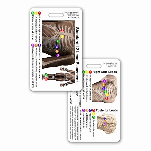 12 Lead EKG Placement Vertical Badge Reference Card (1 Card)