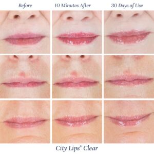 City Beauty City Lips Clear - Plumping Lip Gloss - Hydrate & Volumize - High Shine - Hyaluronic Acid & Peptides Visibly Smooth Lip Wrinkles - Cruelty-Free