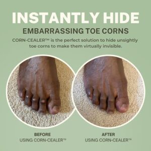 CORN-CEALER | Toe Corn Makeup | Instantly Hide Toe Corns | Concealer For Toe Corns (Shade-NUTMEG)