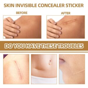 Tattoo Cover Up,Scar Cover Stickers Tape,Waterproof Ultra Thin Patch Pads Concealer Body Leg Bruise Stretch Scar Dark Spots Vitiligo Skin Makeup,Long Lasting Invisible Tattoo Flaw Conceal Patch 60PCS