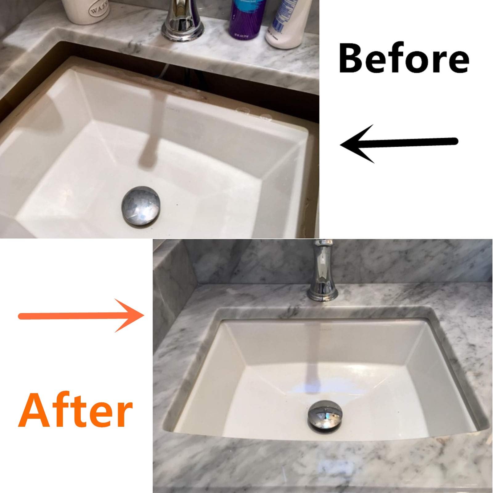 Undermount sink brackets,Undermount sink repair kit, Best undermount sink support,Undermount kitchen sink brackets for fallen sink support.(Patent)